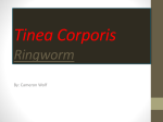 Tinea Corporis Ringworm