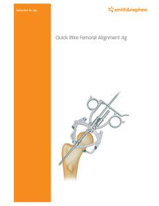 Quick Wire Femoral Alignment Jig
