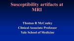 Susceptibility artifacts at MRI - SCBT-MR