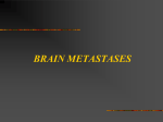 brain metastases