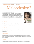 A Bad Bite: What Causes Malocclusion?