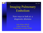 Imaging Pulmonary Embolism
