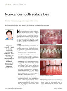 Non-carious tooth surface loss