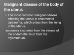 Bengin Tumour of Uterus