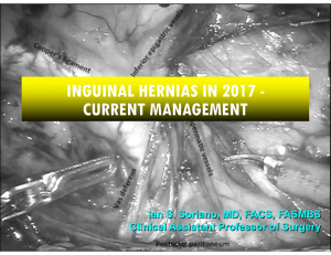 INGUINAL HERNIAS IN 2017