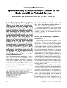 Spontaneously T1-Hyperintense Lesions of the Brain on MRI: A