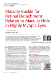 Macular Buckle for Retinal detachment Related to