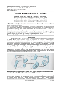 Congenital Anomaly of Cochlea: A Case Report