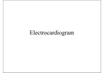 Electrocardiogram