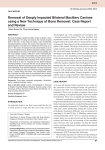 Removal of Deeply Impacted Bilateral Maxillary Canines using a