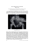 TOTAL DISLOCATION OF THE ILIUM Report of a Case