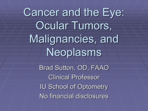 Cancer and the Eye: Ocular Tumors, Malignancies, and Neoplasms