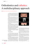 Orthodontics and esthetics: A multidisciplinary approach