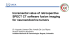 3.Retrospective SPECT CT software fusion imaging [Compatibility