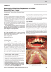 Nonsurgical Maxillary Expansion in Adults: report of two cases