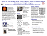 Comparing Retinal Vasculature Using Adaptive Optics, Commercial