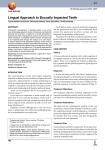 Lingual Approach to Buccally Impacted Teeth