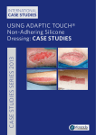 USING ADAPTIC TOUCH® Non-Adhering Silicone Dressing: CASE