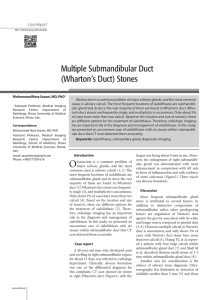 Multiple Submandibular Duct (Wharton`s Duct) Stones