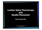 Lumbar Spine Fluoroscopy and Needle Placement