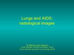 Lungs and AIDS: radiological images