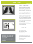 What is a Chest X-Ray?