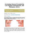 Invisalign Braces Provided By Los Angeles Orthodontist, Sid