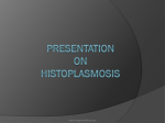 Presentation on Histoplasmosis