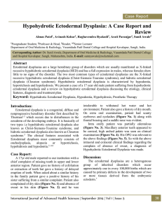 Hypohydrotic Ectodermal Dysplasia: A Case Report and Review
