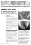 Alveolar bone grafts - Great Ormond Street Hospital