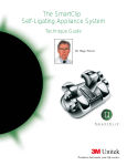 The SmartClip™ Self-Ligating Appliance System