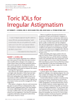 Toric IOLs for Irregular Astigmatism