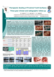 Therapeutic Sealing of Proximal Tooth Surfaces Three