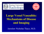 Large Vessel Vasculitis: Mechanisms of Disease and Imaging