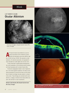 Ocular Albinism