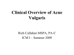 Clinical Overview of Acne Vulgaris