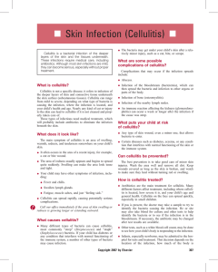 Skin Infection (Cellulitis)