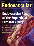 Endovascular Repair of the Superficial Femoral Artery