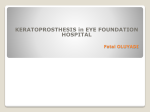 Keratoprosthesis - Eye Foundation Hospital