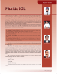 Phakic IOL - dos times