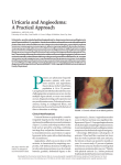 Urticaria and Angioedema: A Practical Approach