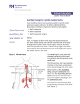 Cardiac Surgery: Aortic Aneurysms