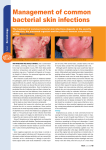 Management of common bacterial skin infections