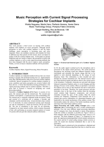 nogueira-Music Perception with Cochlear Implants