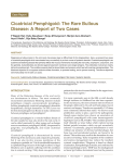 Cicatricial Pemphigoid: The Rare Bullous Disease: A Report of Two