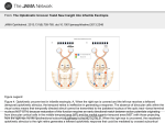 The Optokinetic Uncover TestA New Insight Into Infantile Esotropia