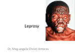 Leprosy - doc meg`s hideout