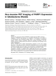Non-invasive PET Imaging of PARP1 Expression in Glioblastoma