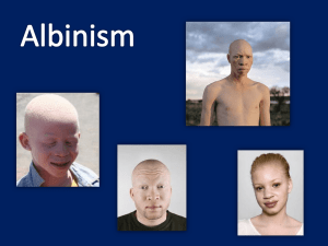 Albinism Project - shsbiogeneticdisorders