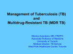 Management of TB and Multidrug